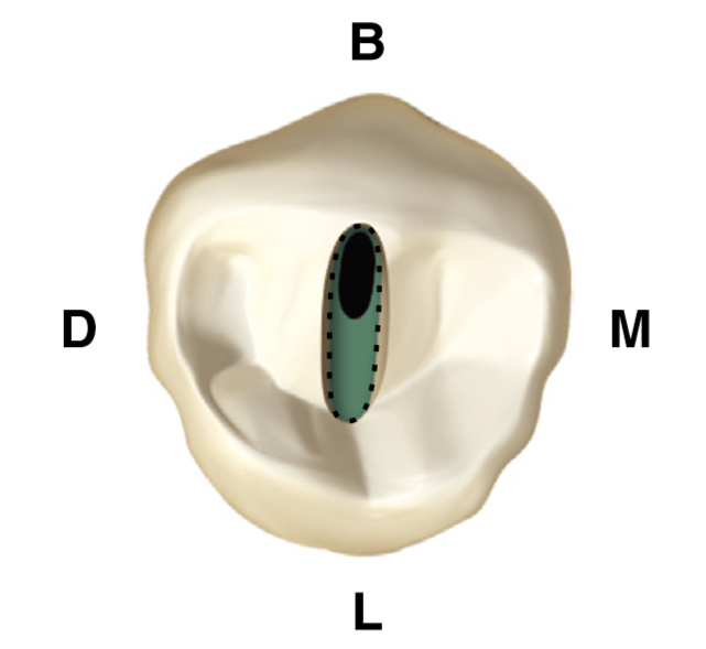 premolar rahang bawah - ummacademy